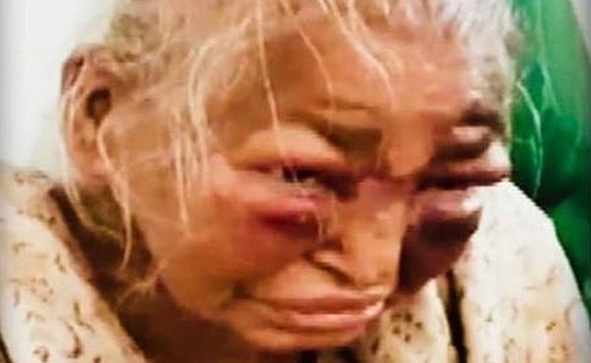 shova पश्चिम बंगाल: पिटाई से घायल 85 वर्षीय महिला की मौत, बीजेपी ने टीएमसी पर साधा निशाना