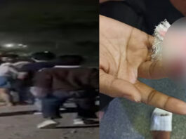 रायपुर में लड़कों का चार लड़कियों पर बर्बर हमला, एक की उंगली काटी गई