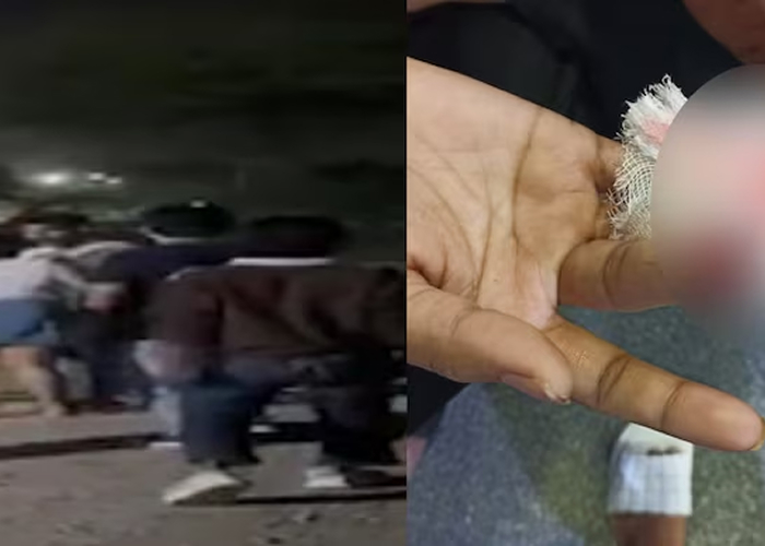 रायपुर में लड़कों का चार लड़कियों पर बर्बर हमला, एक की उंगली काटी गई
